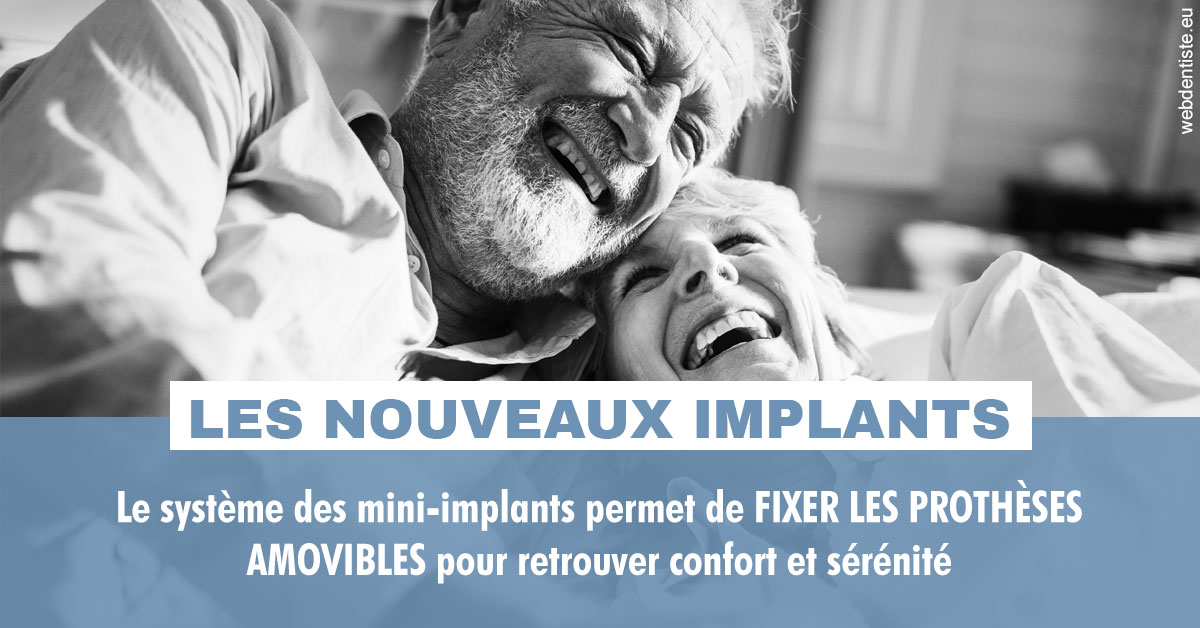 https://selarl-du-docteur-franck-wattinne.chirurgiens-dentistes.fr/Les nouveaux implants 2