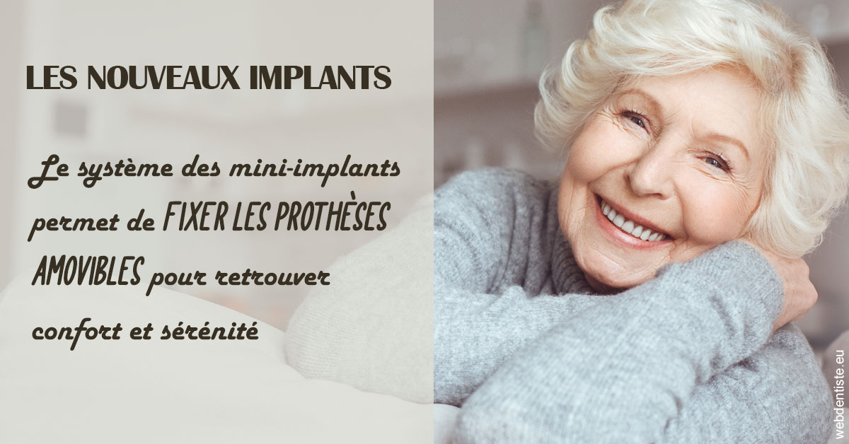 https://selarl-du-docteur-franck-wattinne.chirurgiens-dentistes.fr/Les nouveaux implants 1