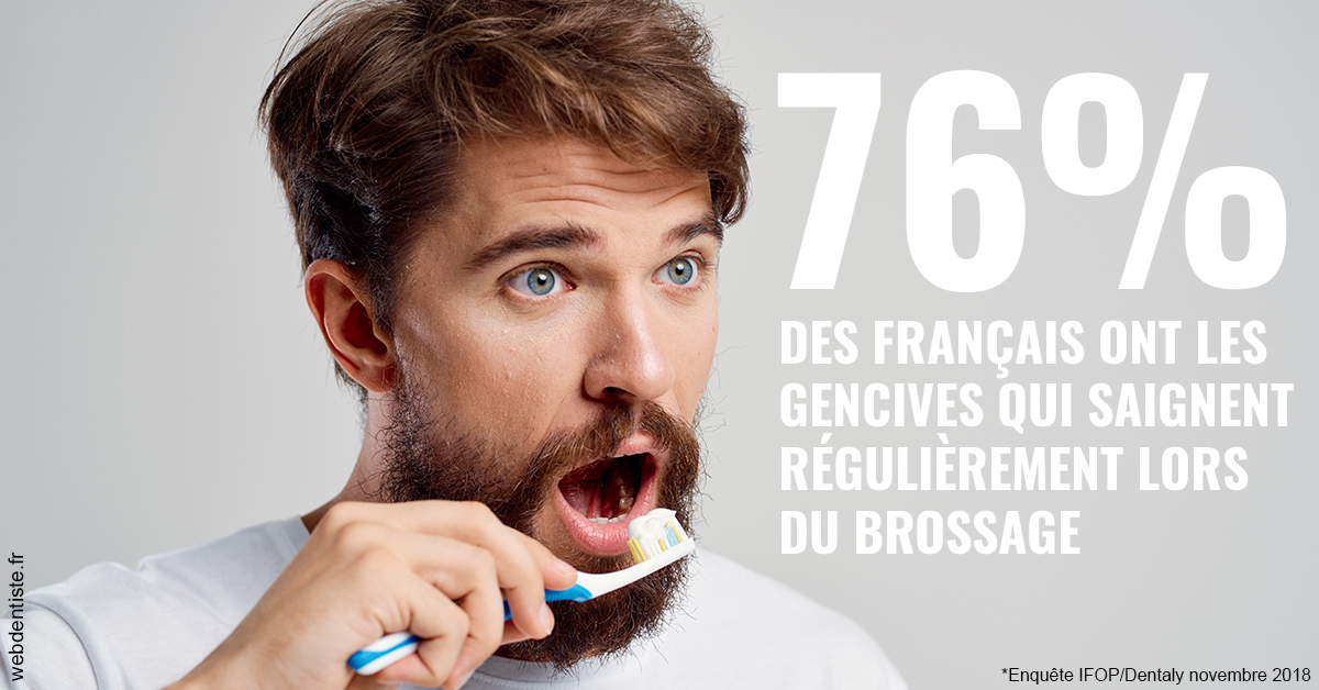 https://selarl-du-docteur-franck-wattinne.chirurgiens-dentistes.fr/76% des Français 2