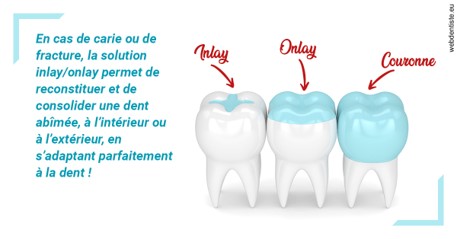 https://selarl-du-docteur-franck-wattinne.chirurgiens-dentistes.fr/L'INLAY ou l'ONLAY