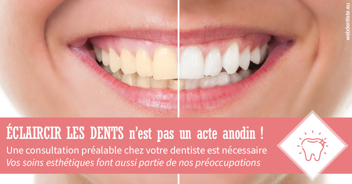 https://selarl-du-docteur-franck-wattinne.chirurgiens-dentistes.fr/Eclaircir les dents 1