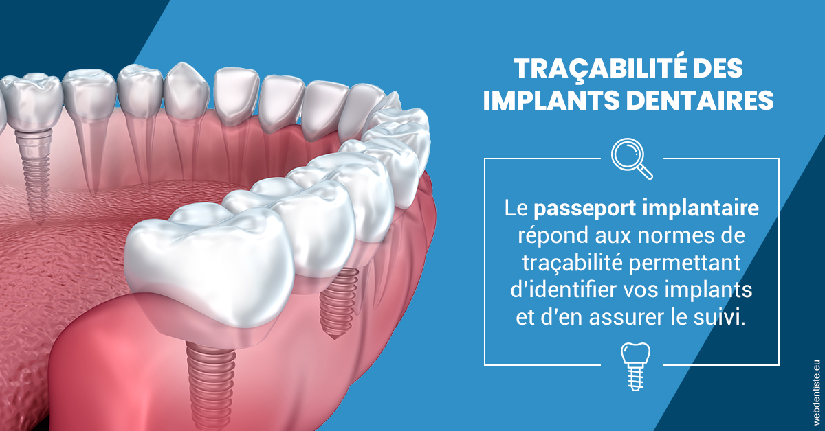 https://selarl-du-docteur-franck-wattinne.chirurgiens-dentistes.fr/T2 2023 - Traçabilité des implants 1