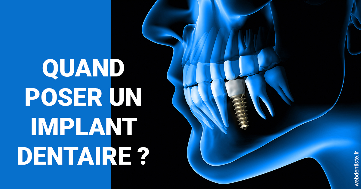 https://selarl-du-docteur-franck-wattinne.chirurgiens-dentistes.fr/Les implants 1