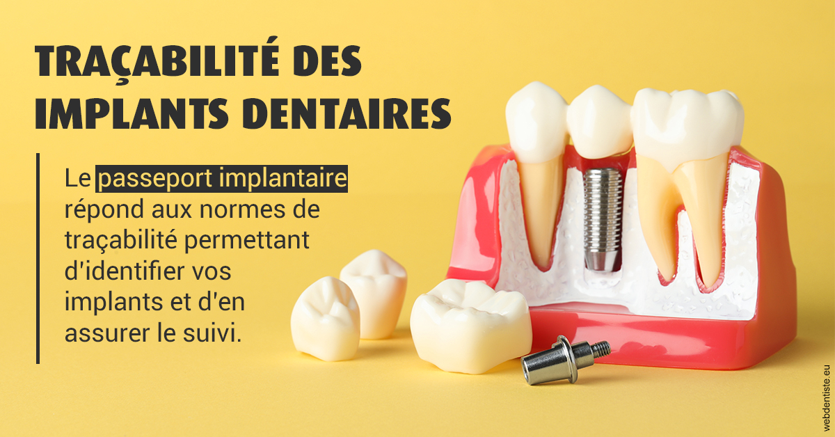 https://selarl-du-docteur-franck-wattinne.chirurgiens-dentistes.fr/T2 2023 - Traçabilité des implants 2
