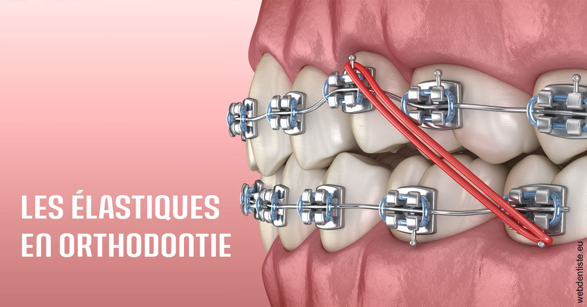 https://selarl-du-docteur-franck-wattinne.chirurgiens-dentistes.fr/Elastiques orthodontie 2