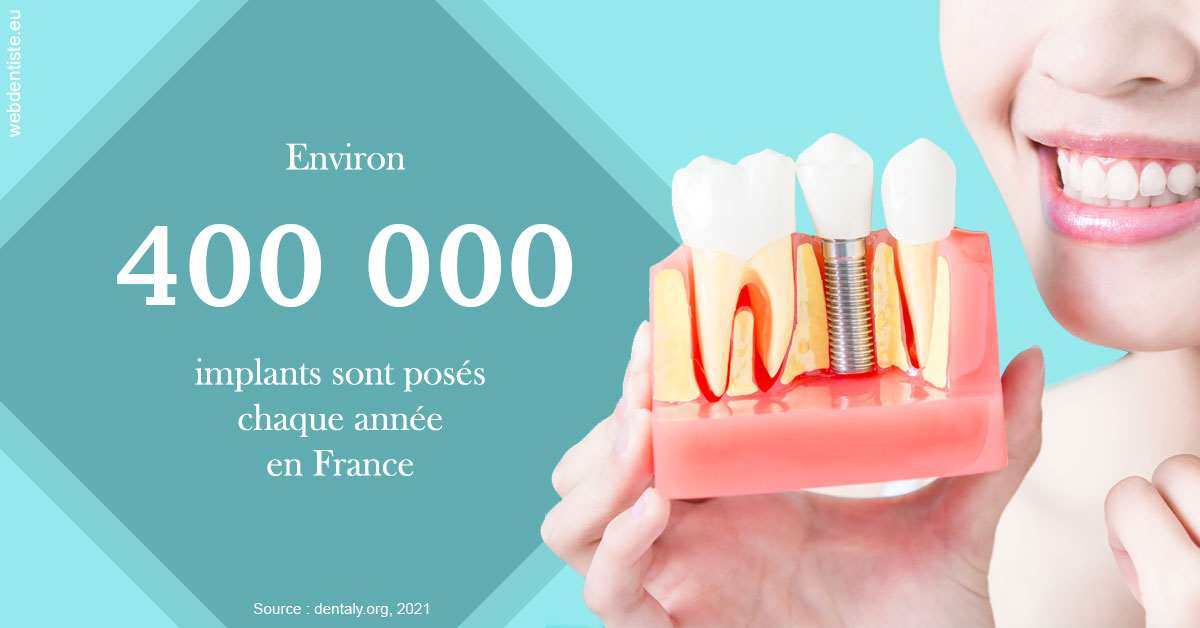 https://selarl-du-docteur-franck-wattinne.chirurgiens-dentistes.fr/Pose d'implants en France 2